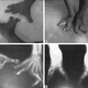 Image for article titled 10 Unusual Genetic Mutations in Humans